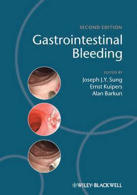 bokomslag Gastrointestinal Bleeding