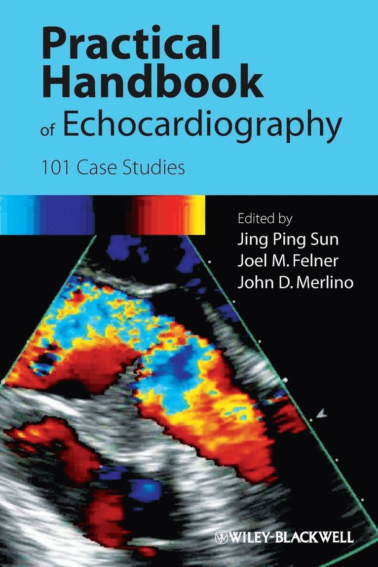Sun, Jing Ping Sun, Joel Felner, John Merlino - Practical Handbook of Echocardiography, Häftad