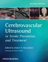 bokomslag Cerebrovascular Ultrasound in Stroke Prevention and Treatment