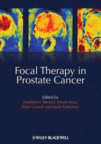 bokomslag Focal Therapy in Prostate Cancer