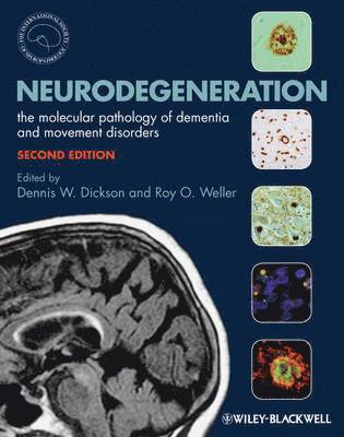Dennis Dickson, Roy O. Weller - Neurodegeneration, Inbunden