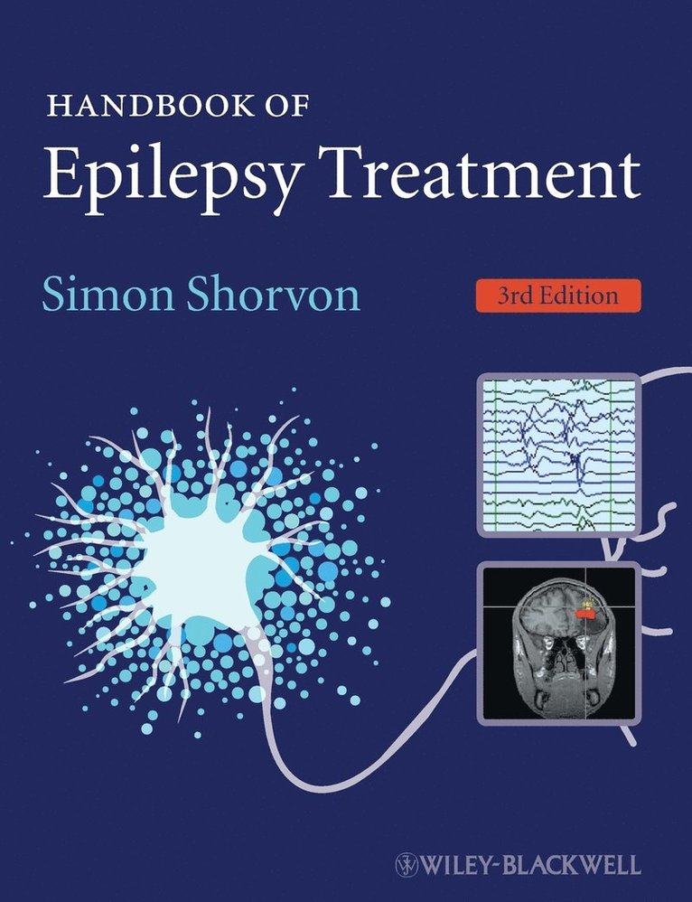 Handbook of Epilepsy Treatment 1