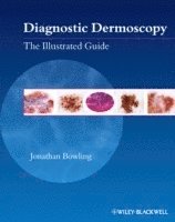 bokomslag Diagnostic Dermoscopy - The Illustrated Guide