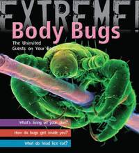 bokomslag Extreme Science: Body Bugs!