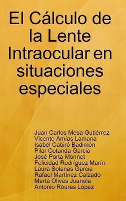 Juan Carlos Mesa Gutierrez, Vicente Amias Lamana, Isabel Cabiro Badimon, Pilar Cotanda Garcia, Jose Porta Monnet, Laura Solanas Garcia, Felicidad Rodriguez Marin, Rafael Martinez Calzado, Marta Olives Juanola, Antonio Rouras Lopez, Juan Carlos Mesa Gutiérrez, Vicente Amías Lamana, Isabel Cabiró Badimón - Calculo De La Lente Intraocular En Situaciones Especiales, Inbunden