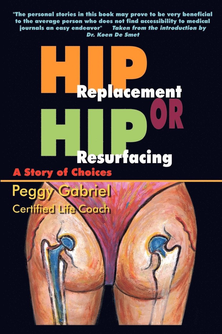 Hip Replacement or Hip Resurfacing: A Story of Choices 1