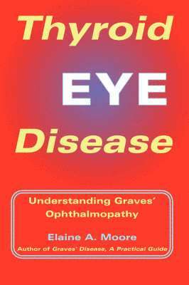 bokomslag Thyroid Eye Disease