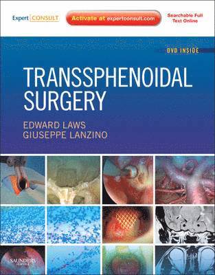 Transsphenoidal Surgery 1