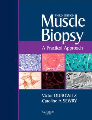 Muscle Biopsy: A Practical Approach 1