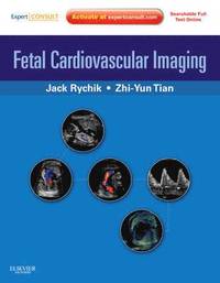 bokomslag Fetal Cardiovascular Imaging: A Disease Based Approach