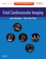 bokomslag Fetal Cardiovascular Imaging: A Disease Based Approach