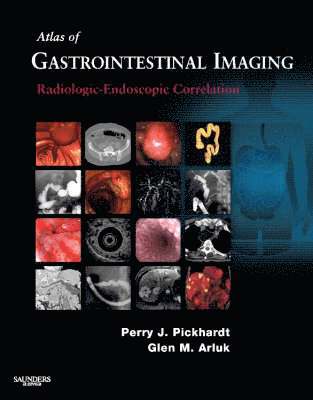 bokomslag Atlas of Gastrointestinal Imaging: Radiologic-Endoscopic Correlation