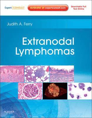 Extranodal Lymphomas 1