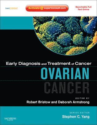 Early Diagnosis and Treatment of Cancer Series: Ovarian Cancer 1