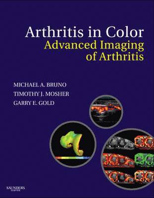 Arthritis in Color 1