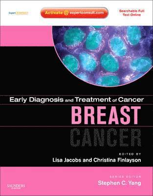 bokomslag Early Diagnosis and Treatment of Cancer Series: Breast Cancer