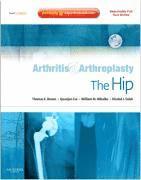 bokomslag Arthritis and Arthroplasty: The Hip