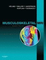 Clyde A. Helms, Nancy M. Major, Mark W. Anderson, Phoebe Kaplan, Robert Dussault - Musculoskeletal MRI, Inbunden