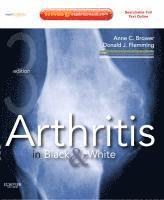 bokomslag Arthritis in Black and White