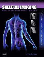 John A. M. Taylor, Tudor H. Hughes, Donald L. Resnick - Skeletal Imaging, Inbunden