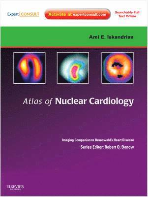 bokomslag Atlas of Nuclear Cardiology: Imaging Companion to Braunwald's Heart Disease