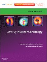 Ami E. Iskandrian, Ernest V. Garcia - Atlas of Nuclear Cardiology: Imaging Companion to Braunwald's Heart Disease, Inbunden