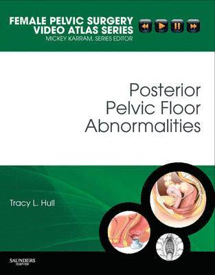 bokomslag Posterior Pelvic Floor Abnormalities