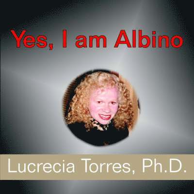 Yes, I am Albino 1