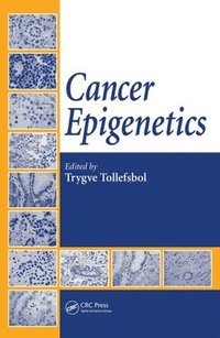bokomslag Cancer Epigenetics