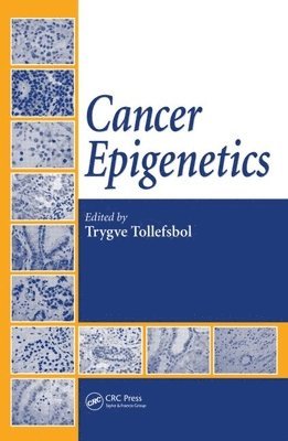 Cancer Epigenetics 1