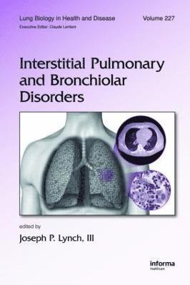 bokomslag Interstitial Pulmonary and Bronchiolar Disorders