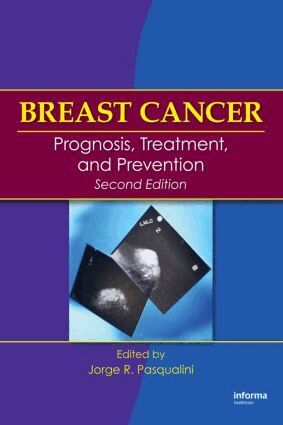 Jorge R. Pasqualini - Breast Cancer, Inbunden