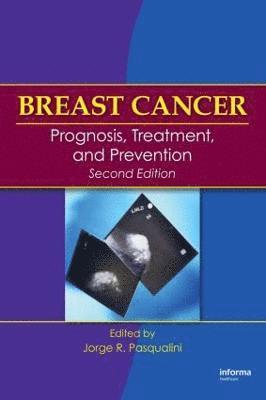 bokomslag Breast Cancer