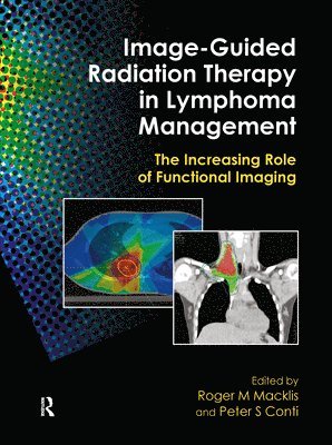 Roger M. Macklis, Peter S. Conti - Image-Guided Radiation Therapy in Lymphoma Management, Inbunden