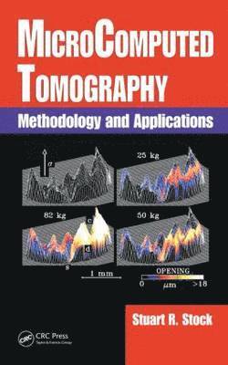 Microcomputed Tomography: Methodology and Applications