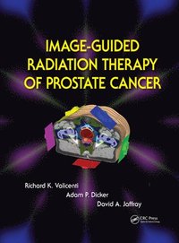 bokomslag Image-Guided Radiation Therapy of Prostate Cancer