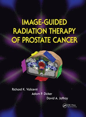 Image-Guided Radiation Therapy of Prostate Cancer 1