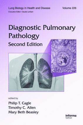 Philip T. Cagle, Timothy C. Allen, Mary Beth Beasley - Diagnostic Pulmonary Pathology, Inbunden