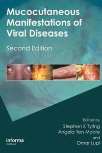 bokomslag Mucocutaneous Manifestations of Viral Diseases