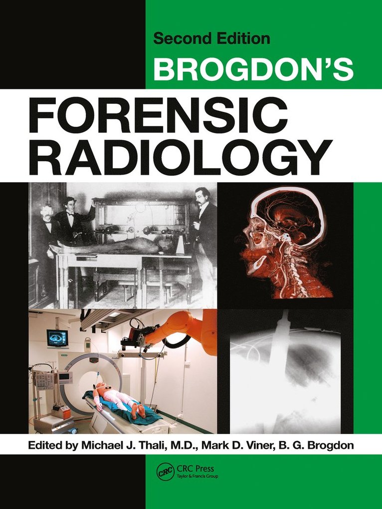 Brogdon's Forensic Radiology 1