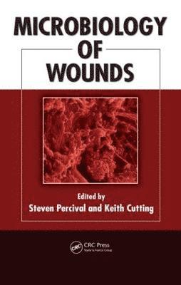 Microbiology of Wounds 1