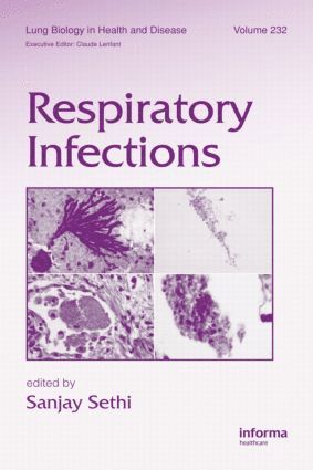 bokomslag Respiratory Infections