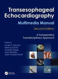 bokomslag Transesophageal Echocardiography Multimedia Manual