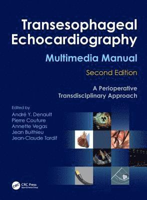 Transesophageal Echocardiography Multimedia Manual 1