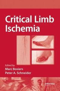 bokomslag Critical Limb Ischemia