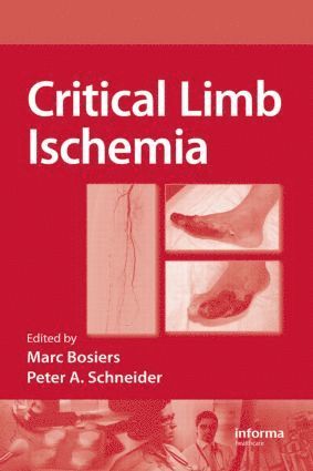 bokomslag Critical Limb Ischemia