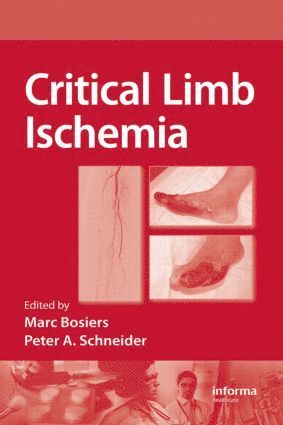 Marc Bosiers, Peter Schneider - Critical Limb Ischemia, Inbunden