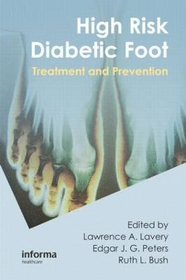 bokomslag High Risk Diabetic Foot