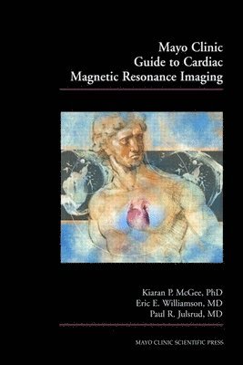 Mayo Clinic Guide to Cardiac Magnetic Resonance Imaging 1