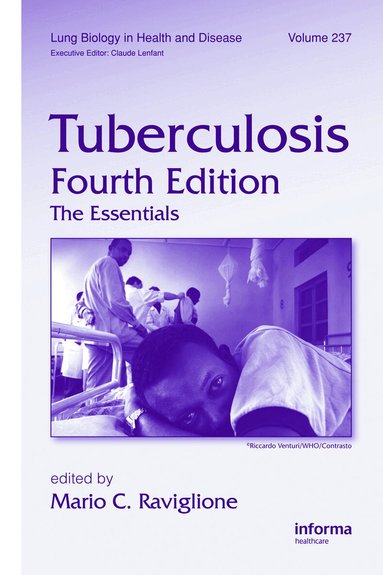 Mario C. Raviglione - Tuberculosis, Inbunden